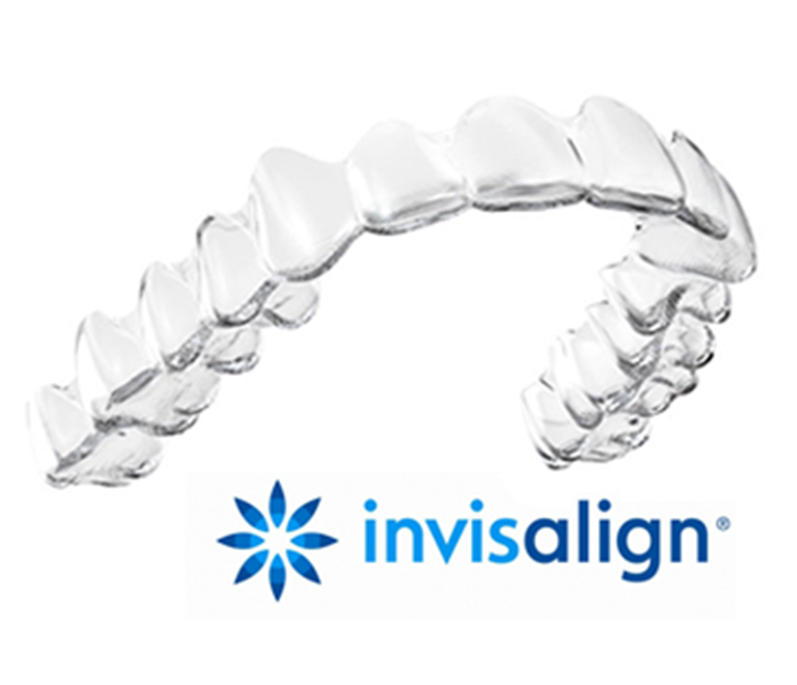 マウスピース矯正